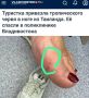 «Туристка привезла тропического червя в ноге из Таиланда»: Из отпуска домой можно привезти и живого червя, даже не догадываясь об этом