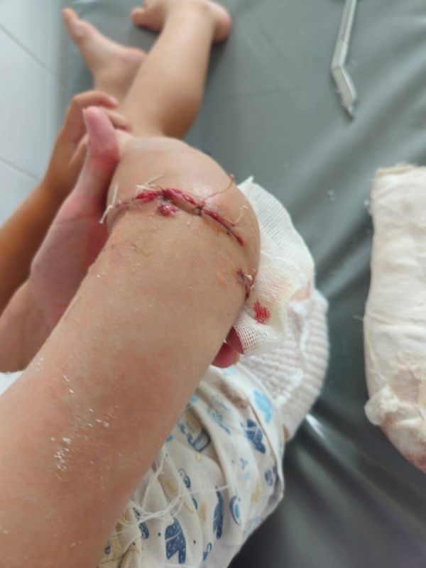 Домашняя собака напала на двухлетнего мальчика, проводится проверка