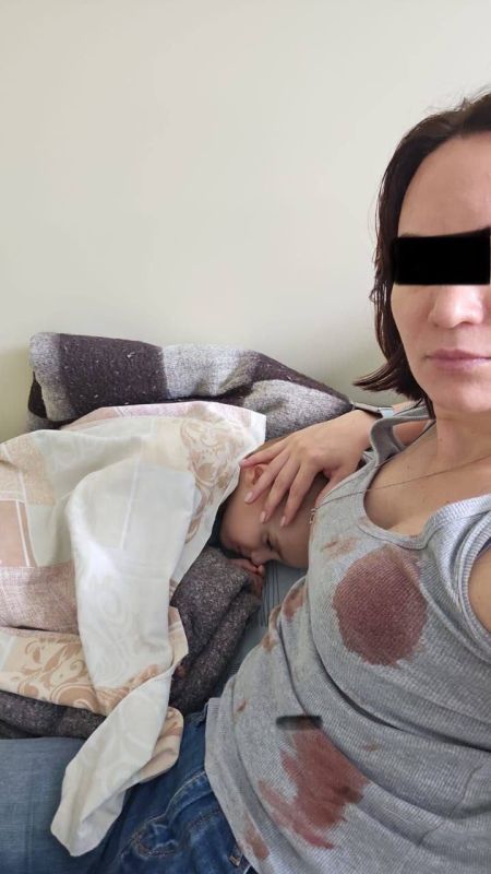 Во Владивостоке прокуратура вмешалась в дело о нападении собаки на ребёнка из-за затянувшегося расследования