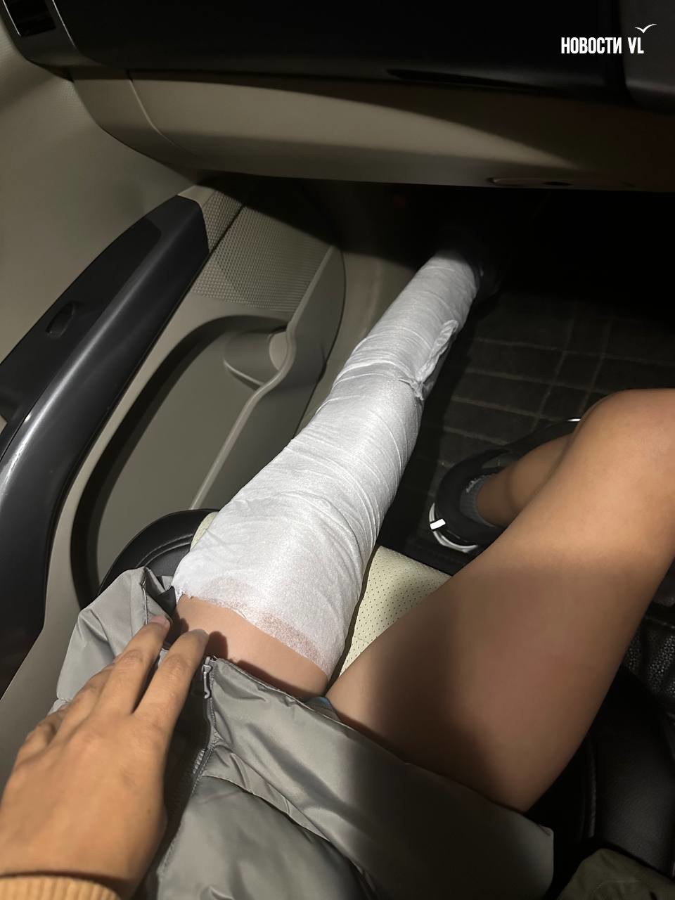 Неизвестный автомобиль сбил на пешеходном переходе 12-летнего мальчика