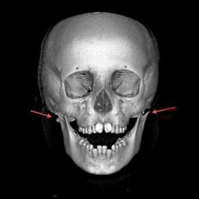 ������ � ������ ������ �������, ������� �� ������� �����