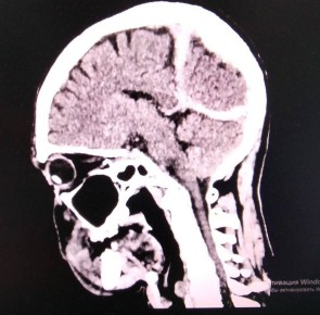 � �������� ����� ������ �������� � ������� �������� � ��������������� ����� ������� �� ��������� ������