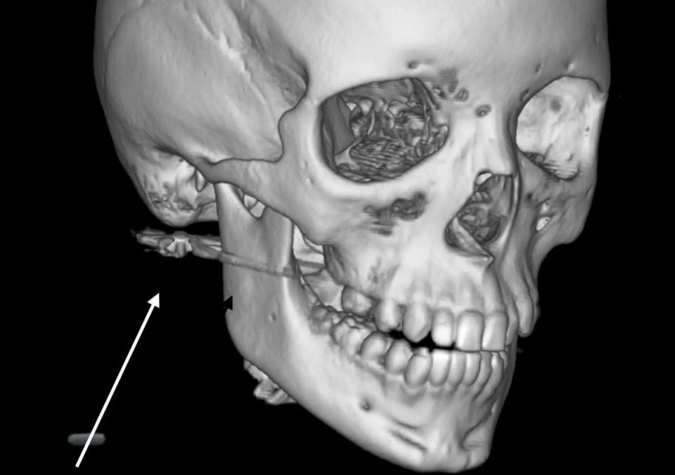 ������� �� ������������ �������� �� ���� ��������� ���� �� ���������