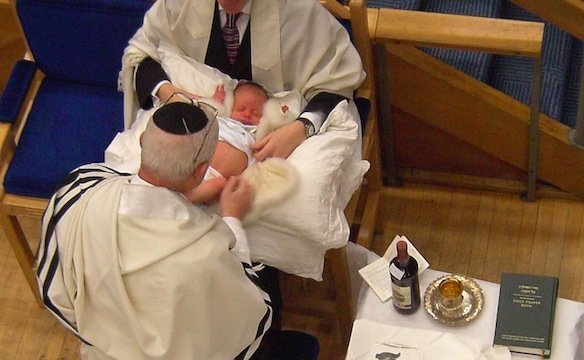 Обрезание у мужчин: преимущества и особенности процедуры