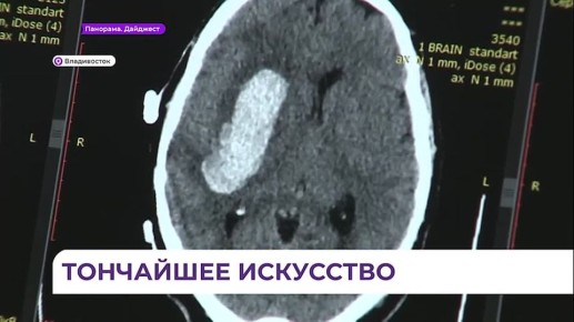 �� ������������ ����� ��������� ������������� ������ �������� �������