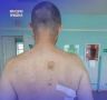 В Октябрьской районной больнице Приморья спасли мужчину с тяжёлым ножевым ранением