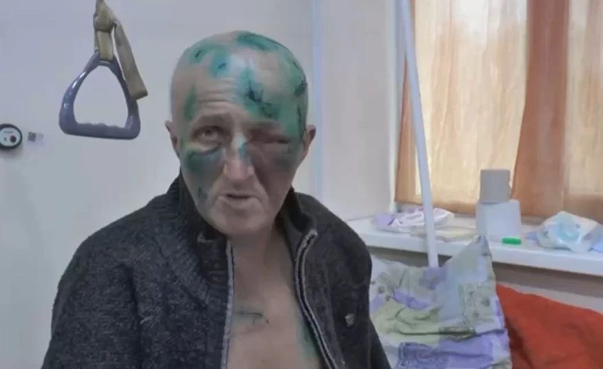 Медведь напал на жителя села Ленино Чугуевского муниципального округа Приморья во время рыбалки