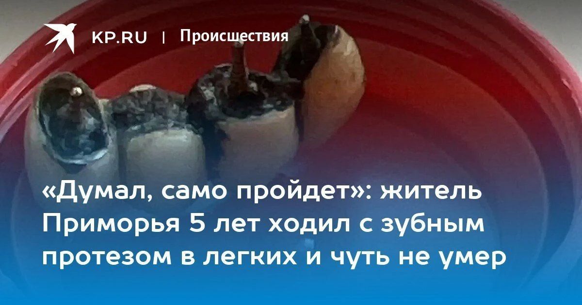 В Приморье 43-летний мужчина пять лет жил с зубным протезом в легких